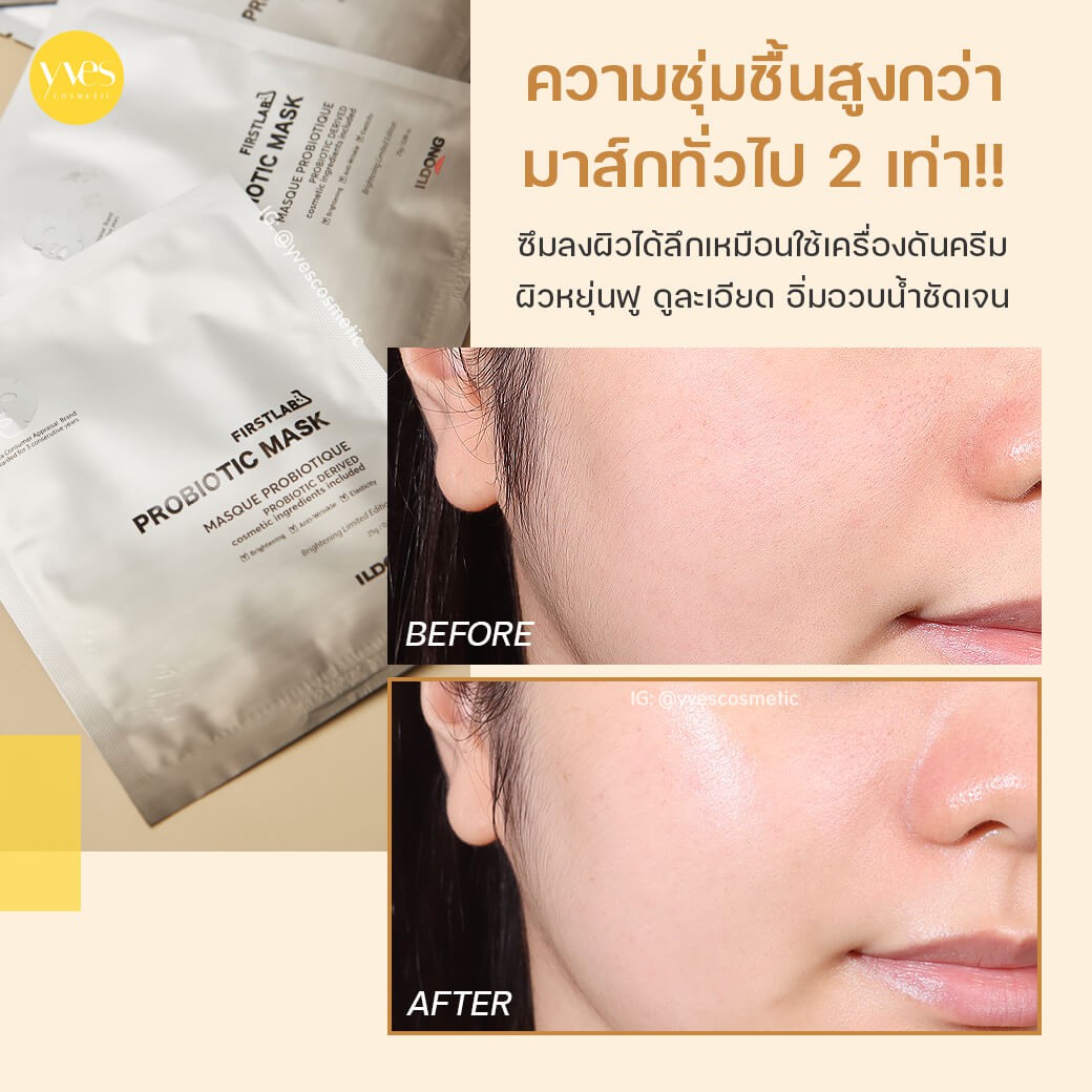 Ildong Firstlab Probiotic Mask Yvescosmetic